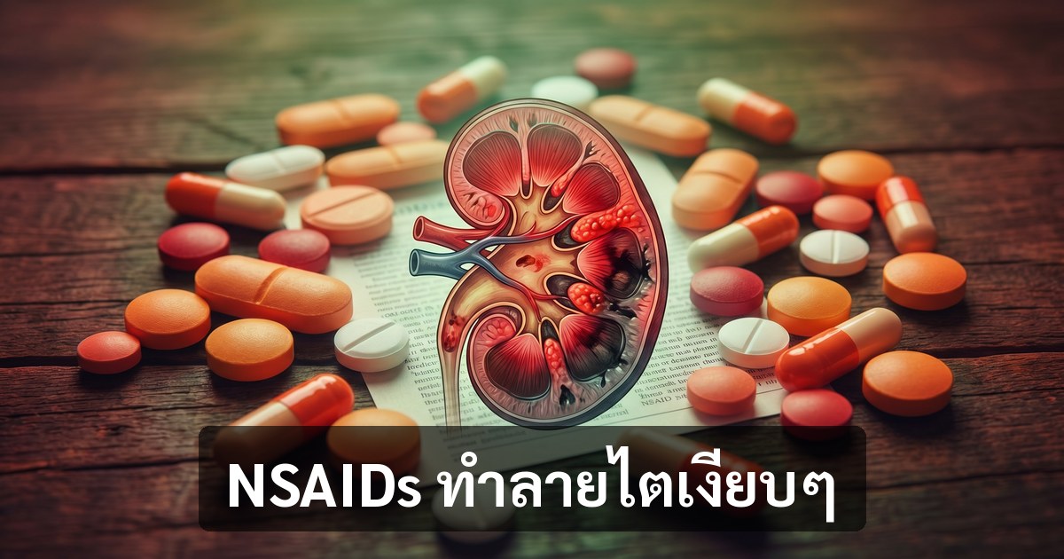img blog 10 nsaids og 1200x630 1