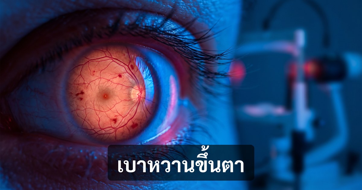 img blog 23 diabetic retinopathy og 1200x630 1